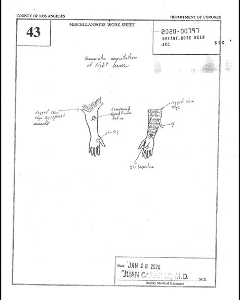 kobe and gigi autopsy|Autopsy Reports for Kobe Bryant, Daughter Gigi and 7 Victims of。